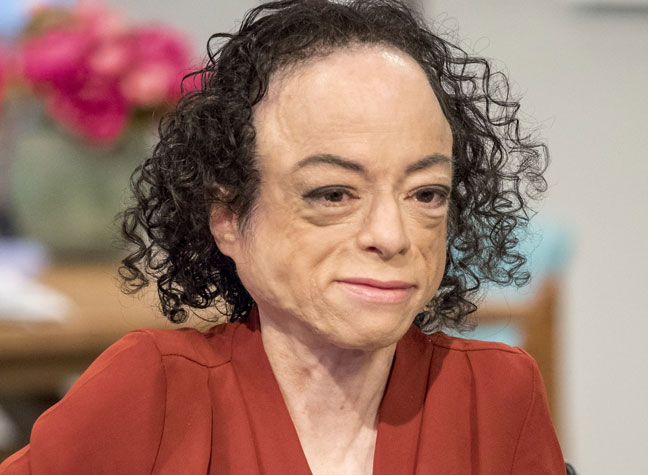 Next photo of Liz Carr